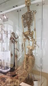 Anatomisch Museum Leiden